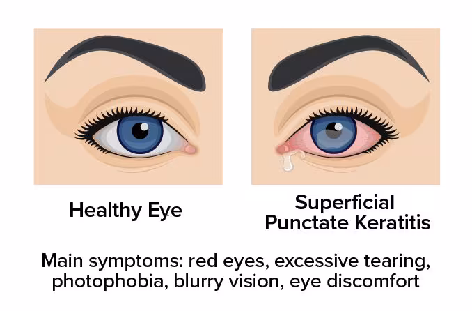 Why Proper Welding Eye Protection Is Essential